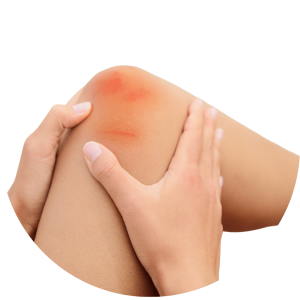 Image of hands holding a scrapped knee.