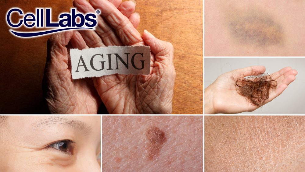 Collage on signs of aging such as wrinkles, dry skin, age spots, bruising, and hair loss.