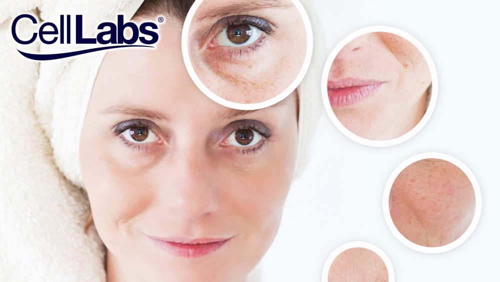 Image of woman with signs of aging.
