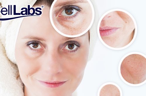 Image of woman with signs of aging.