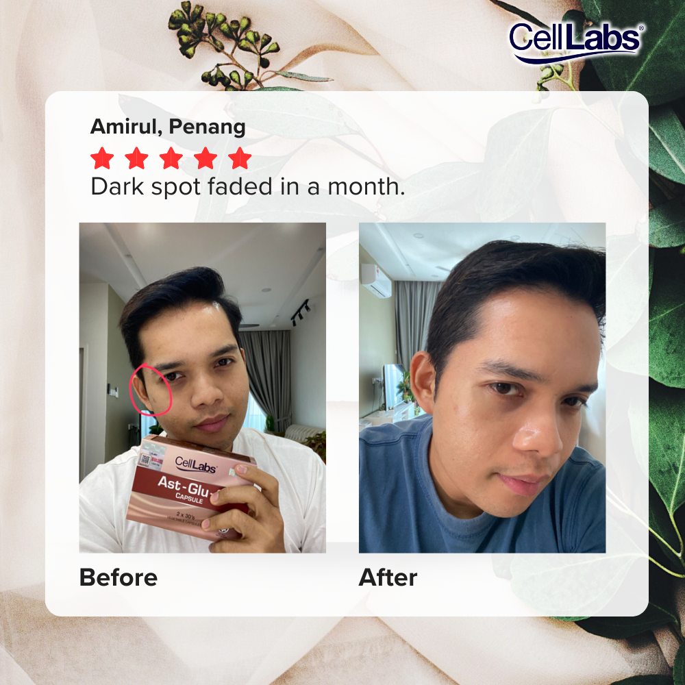Amirul's before and after for CellLabs Ast-Glu-C.