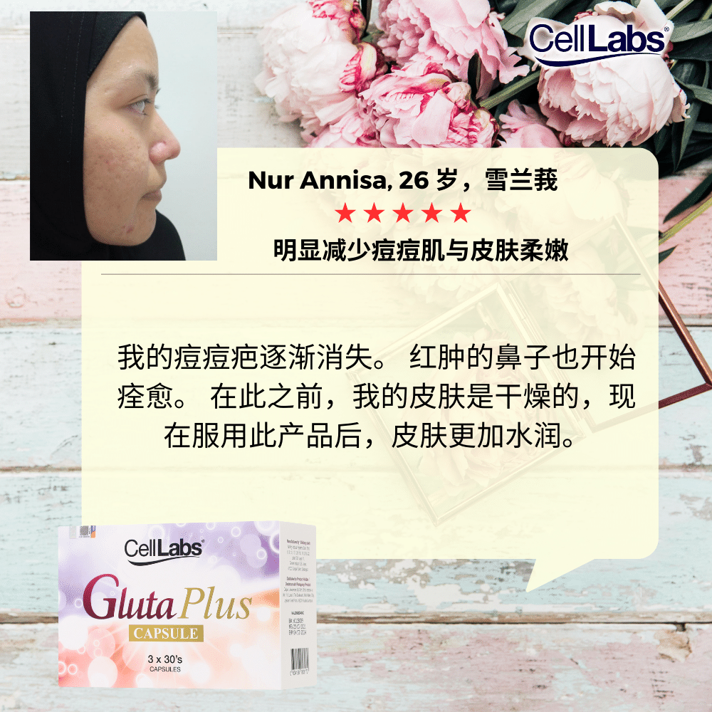 Nur Annisa CN